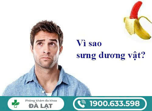 Hình ảnh minh họa